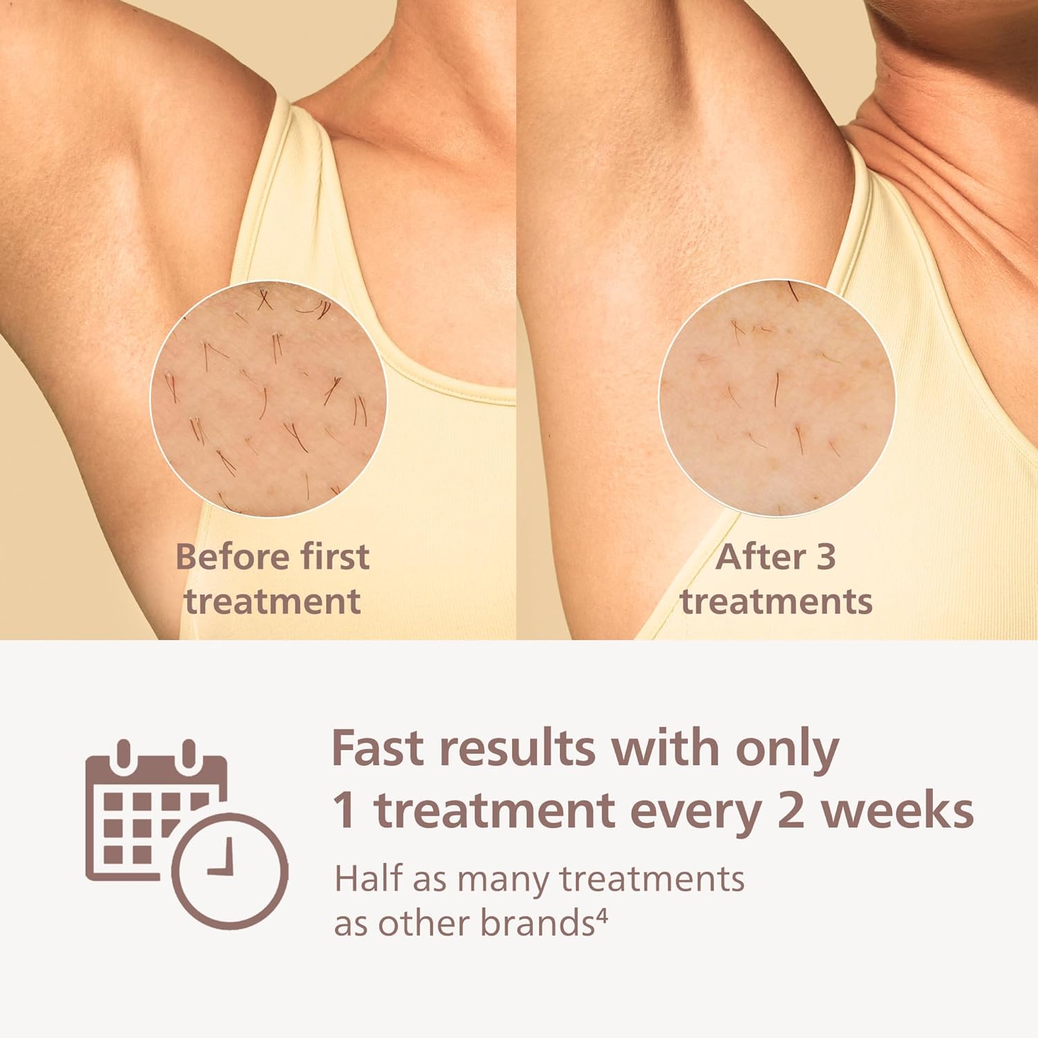 Lumea 9000 Series IPL Hair Removal Device - Permanent Visible Hair Reduction Done at Home